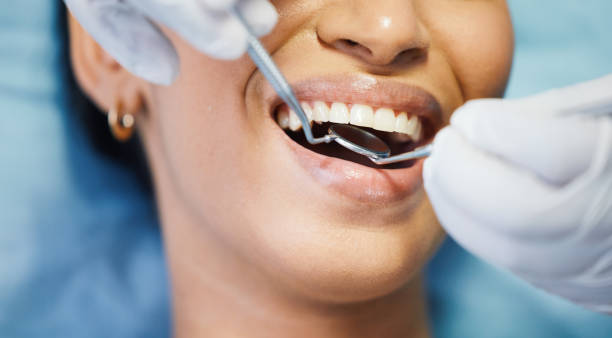 Laser Dentistry in Buena Vista, GA